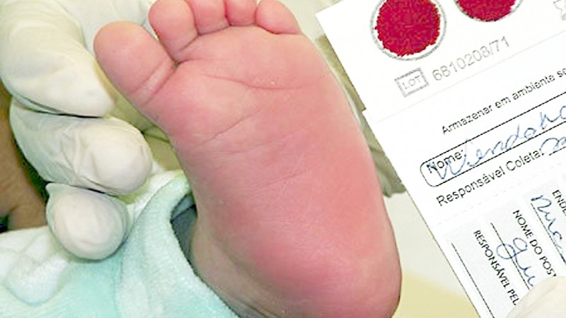 Foto mostra o pé de um bebê. Ao lado, o resultado do exame. 